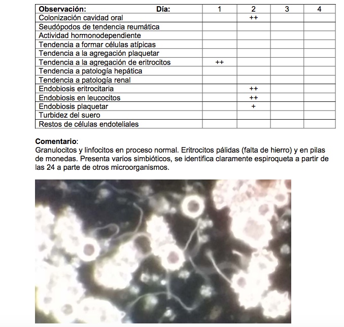 espiroquetes_camp_fosc.jpeg